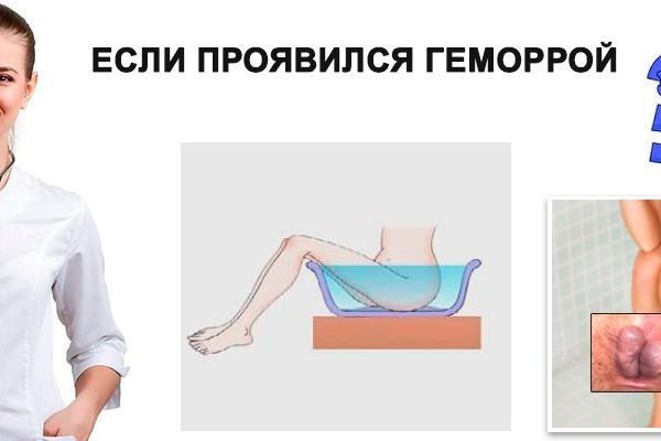Рабочая ссылка на кракен